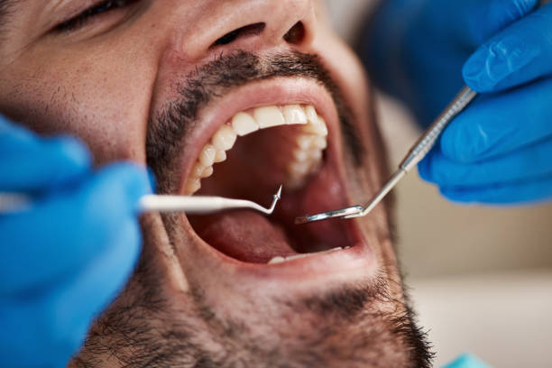 Best Emergency Tooth Extraction in Ingram, TX