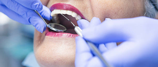 Best Emergency Tooth Extraction in Ingram, TX