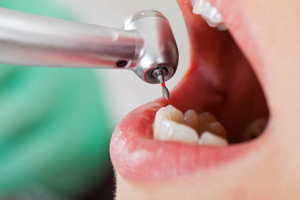 Best Emergency Gum Treatment in Ingram, TX